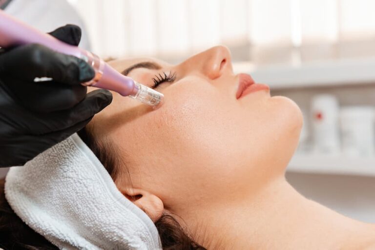 Woman receiving a microneedling treatment on her face, with a professional using a microneedling device to rejuvenate the skin.