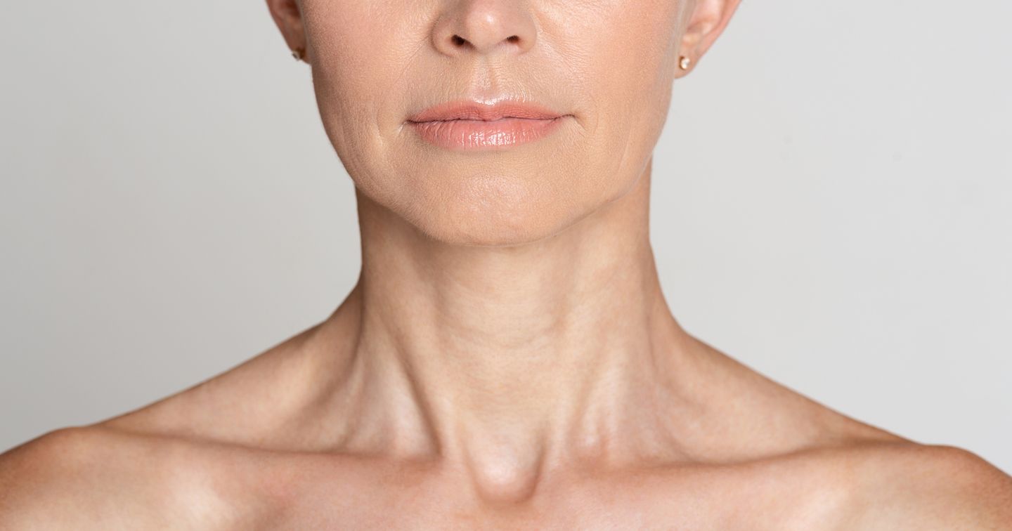 elegant mature woman with smooth youthful jawline and neck after facelift