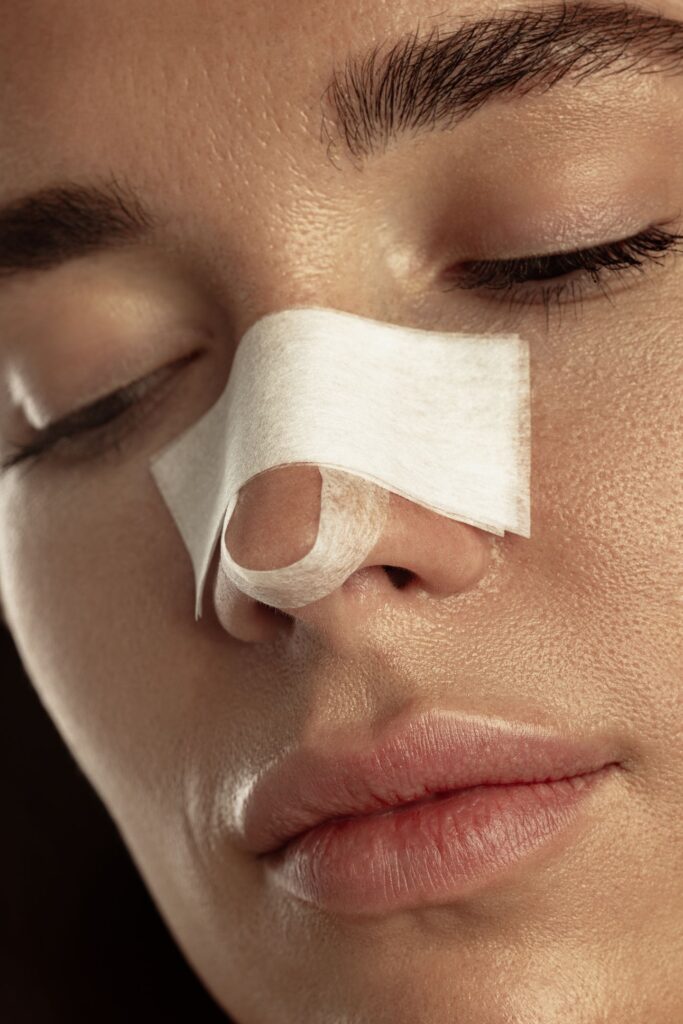 woman resting with white bandage on nose after rhinoplasty recovery